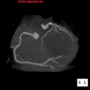 心臓CT画像