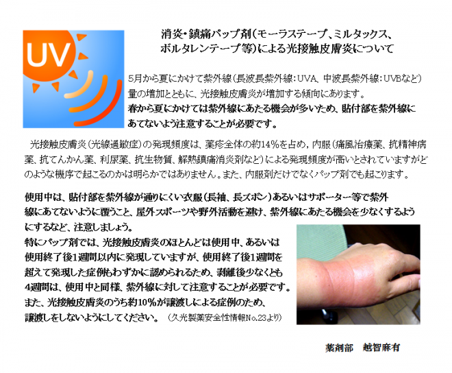 消炎・鎮痛パップ剤による光接触皮膚炎について